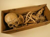 A late 19th/early 20thC human skeleton to include skull