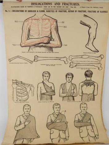 A set of six early 20thC anatomical and medical diagrams