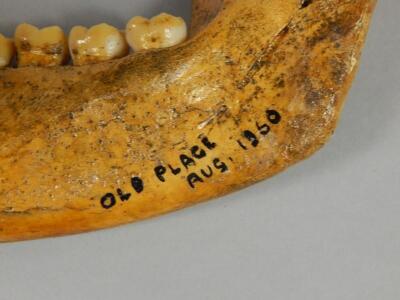 A section of human jaw bone - 3