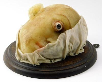 A late 19th/early 20thC French wax medical profile