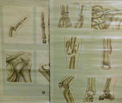 Four J Teck anatomical posters, for The St John Ambulance Association, comprising Fractures of the Leg, Foot and Hand., New Circulation., Breaks of the Finger, Foot , Hand, etc., and General Anatomy II. Various sizes. - 2