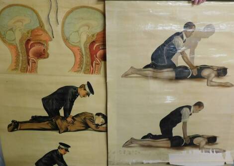 Two Ruddiman Johnstone & Company anatomical posters, illustrating leg breaks and fractures, 46cm high, 75cm wide, together with three posters from The Educational Supply Association, illustrating resuscitation techniques. (5)