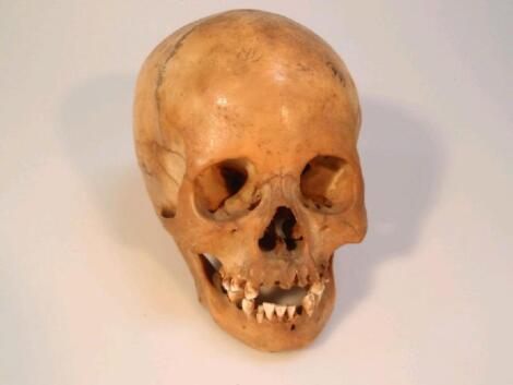 A human skull, with archaeological inscription in black ink - 'Inca, 2000 years?'